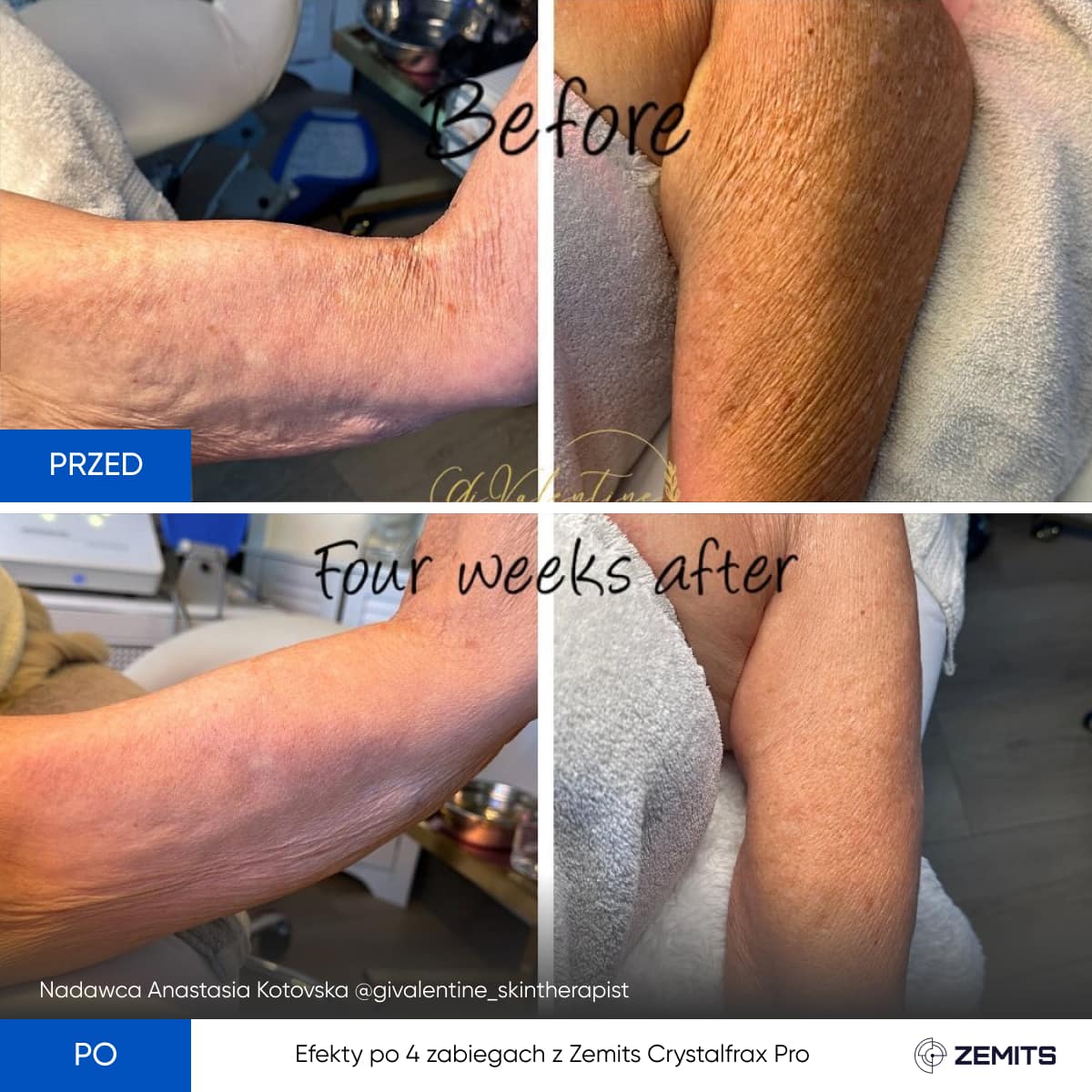 Before After Slide 6