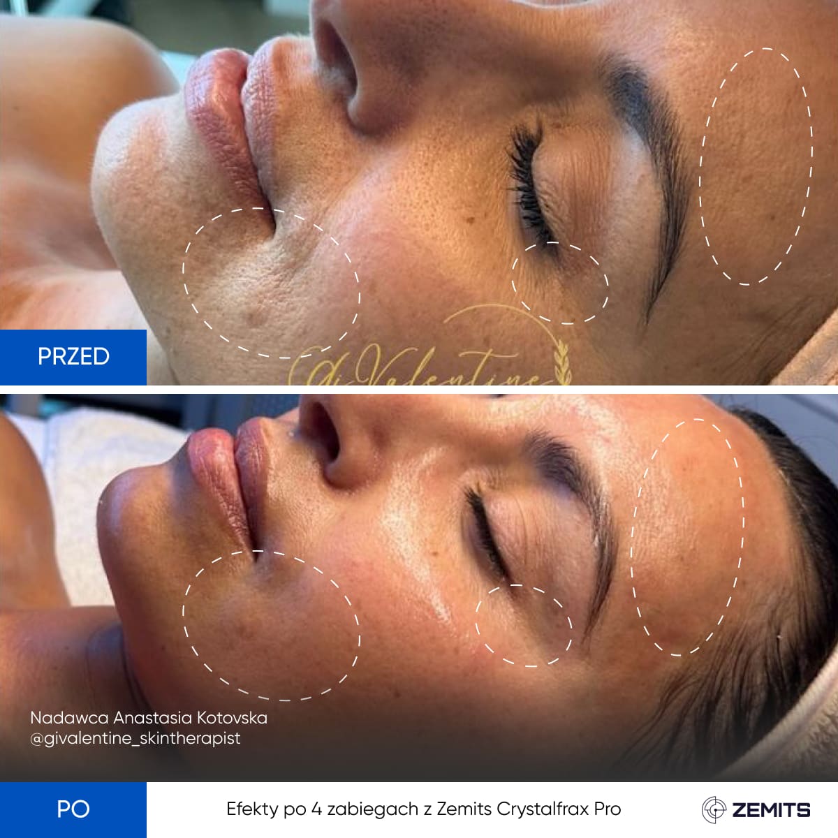 Before After Slide 7