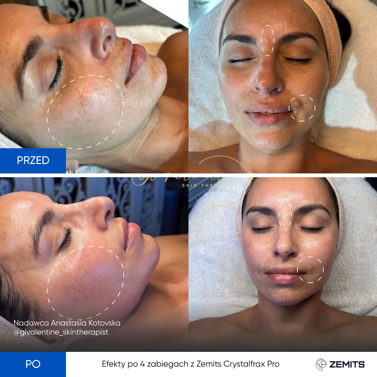 Before After Slide 8