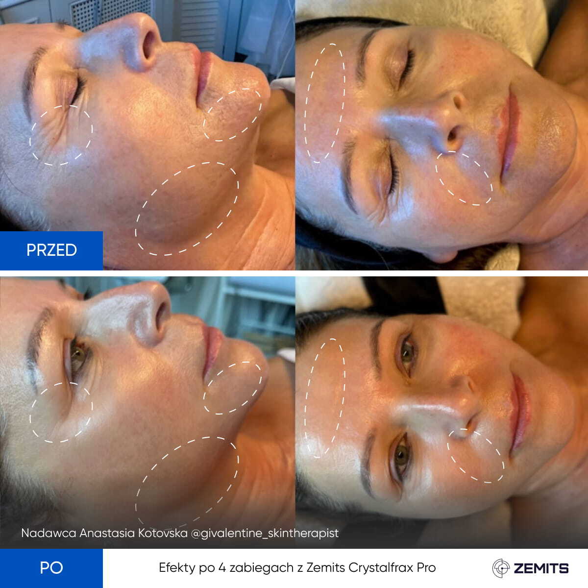 Before After Slide 9