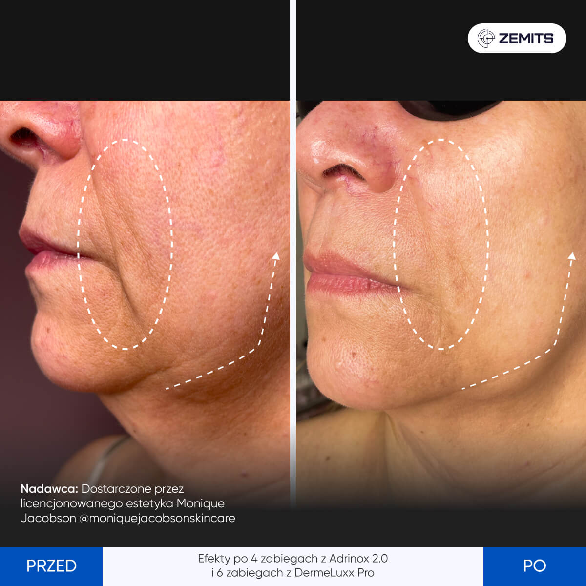 Before After Slide 2