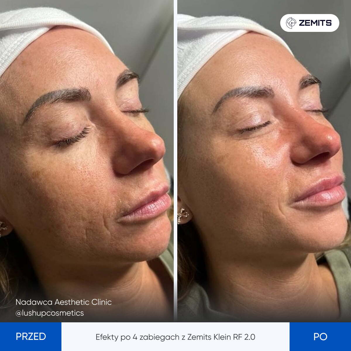 Before After Slide 9
