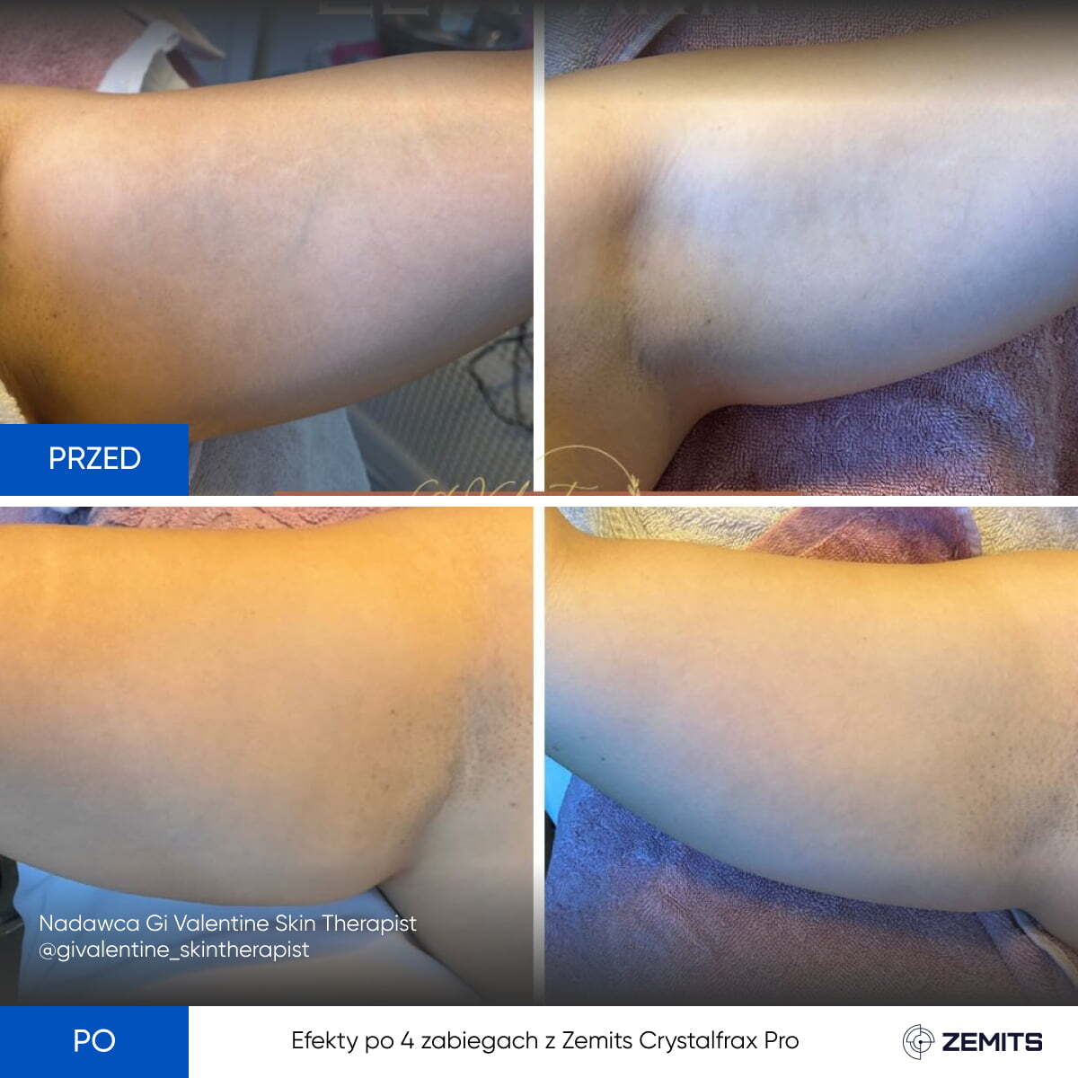 Before After Slide 2