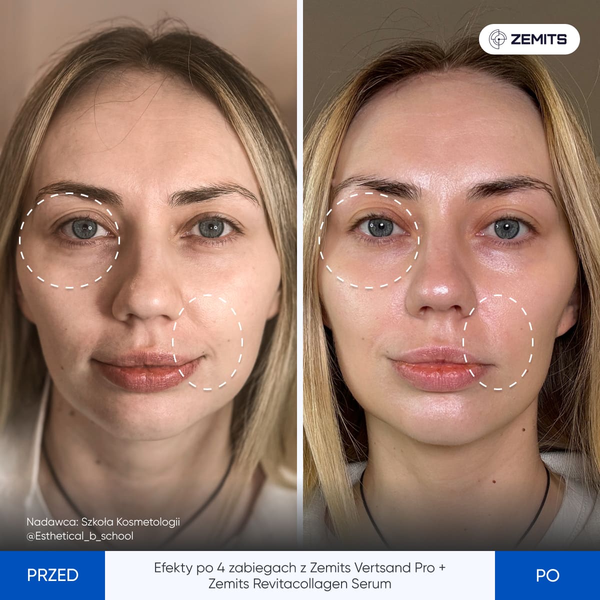 Before After Slide 2