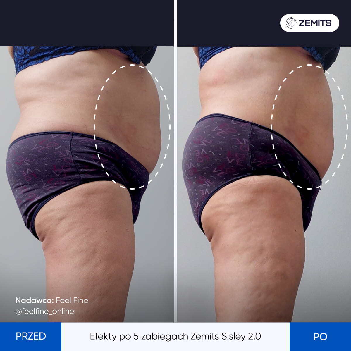 Before After Slide 3