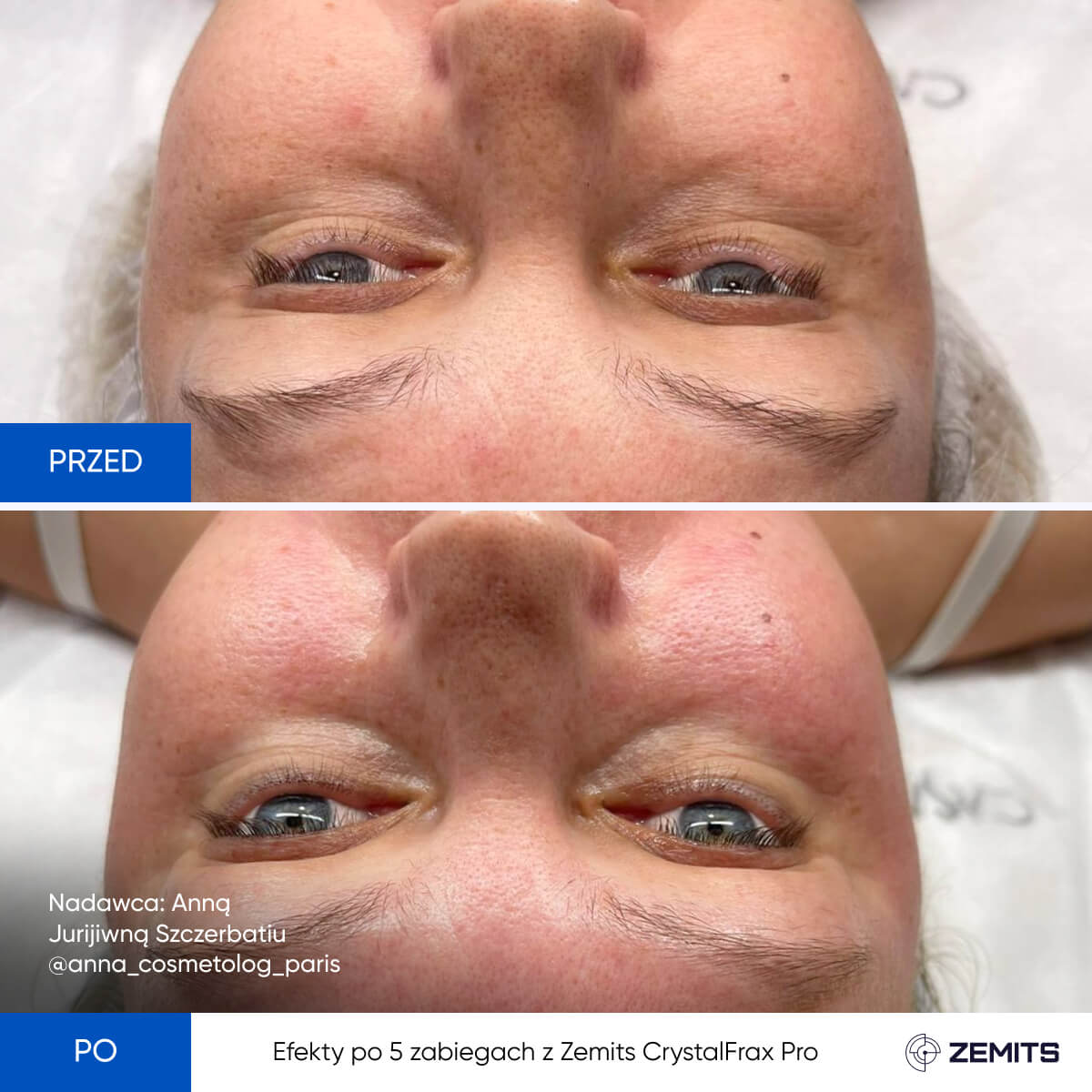 Before After Slide 12