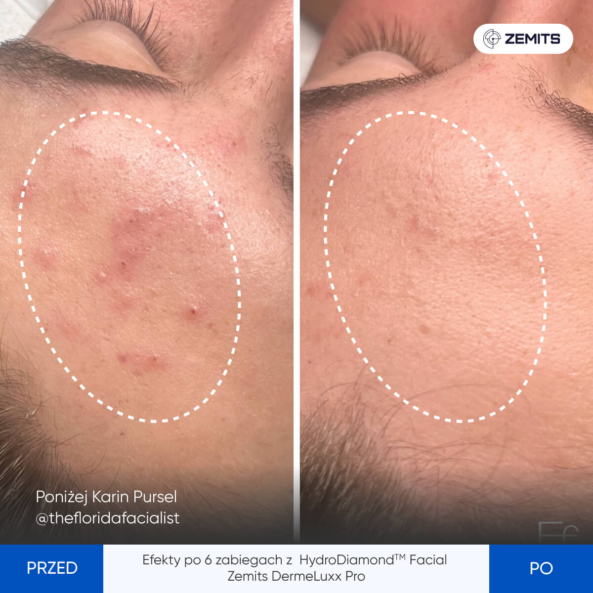 Before After Slide 5
