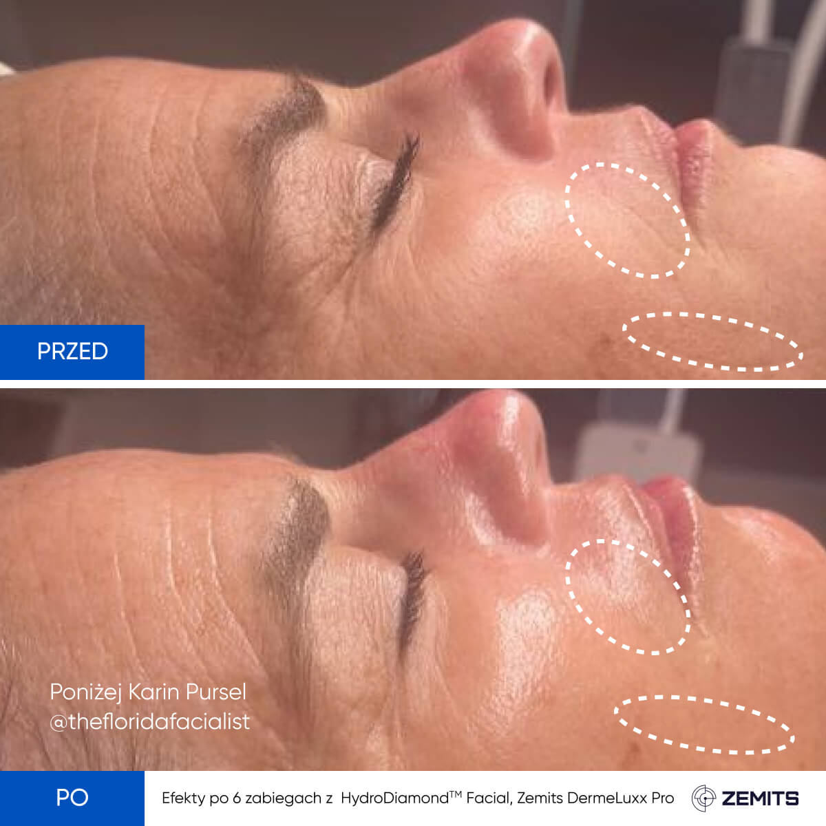Before After Slide 4
