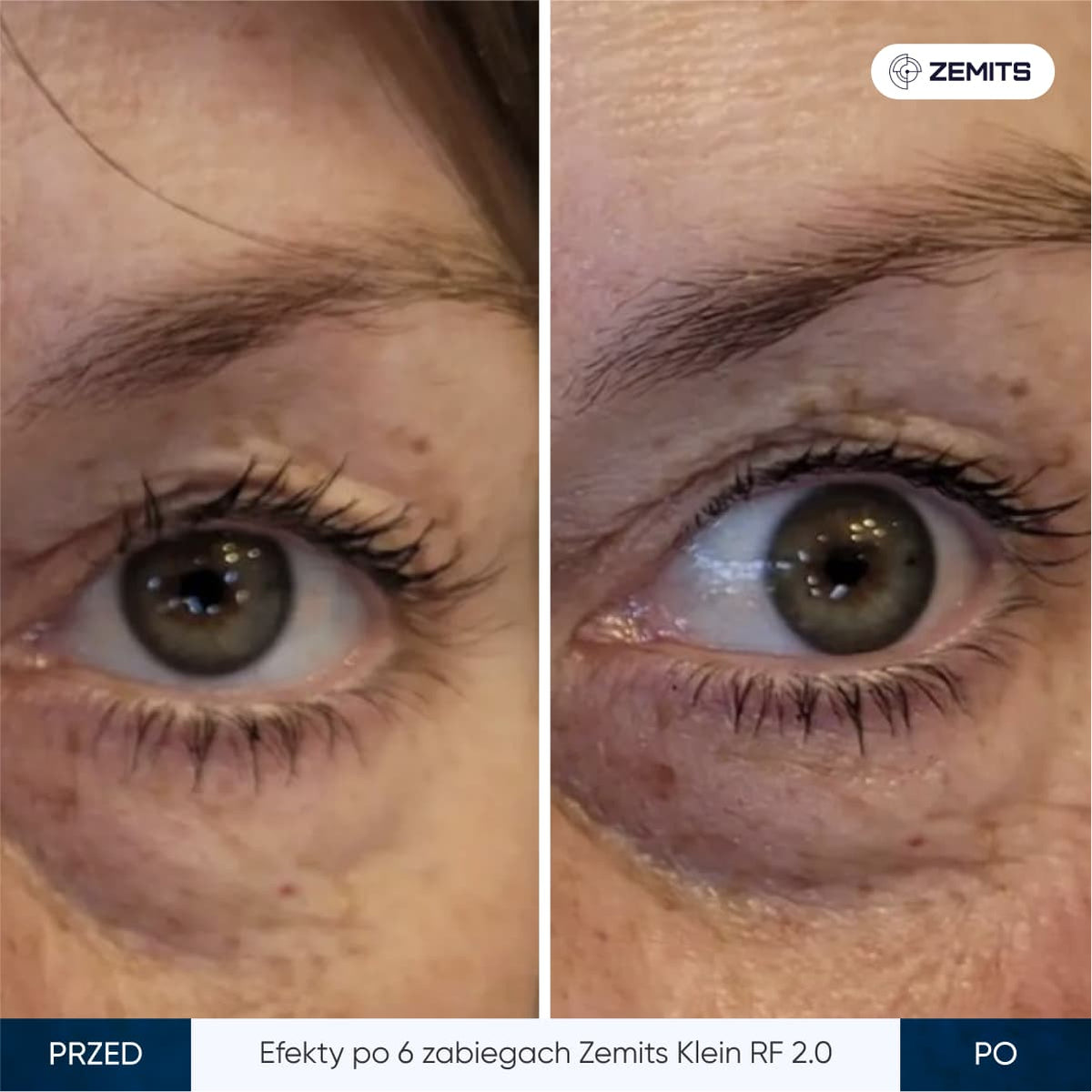 Before After Slide 10