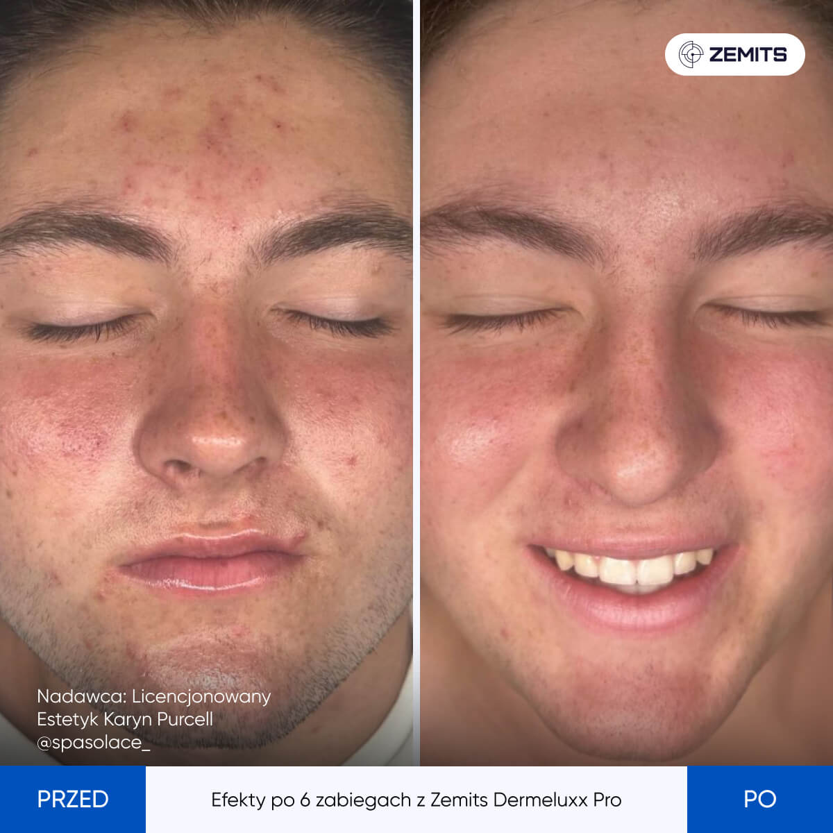 Before After Slide 17