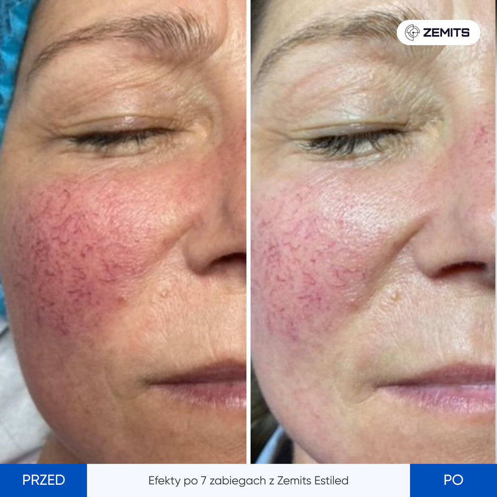 Zemits EstiLED