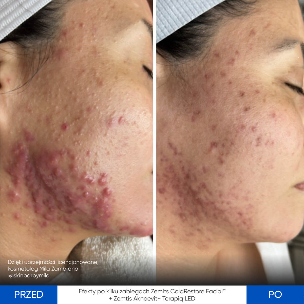 Before After Slide 5