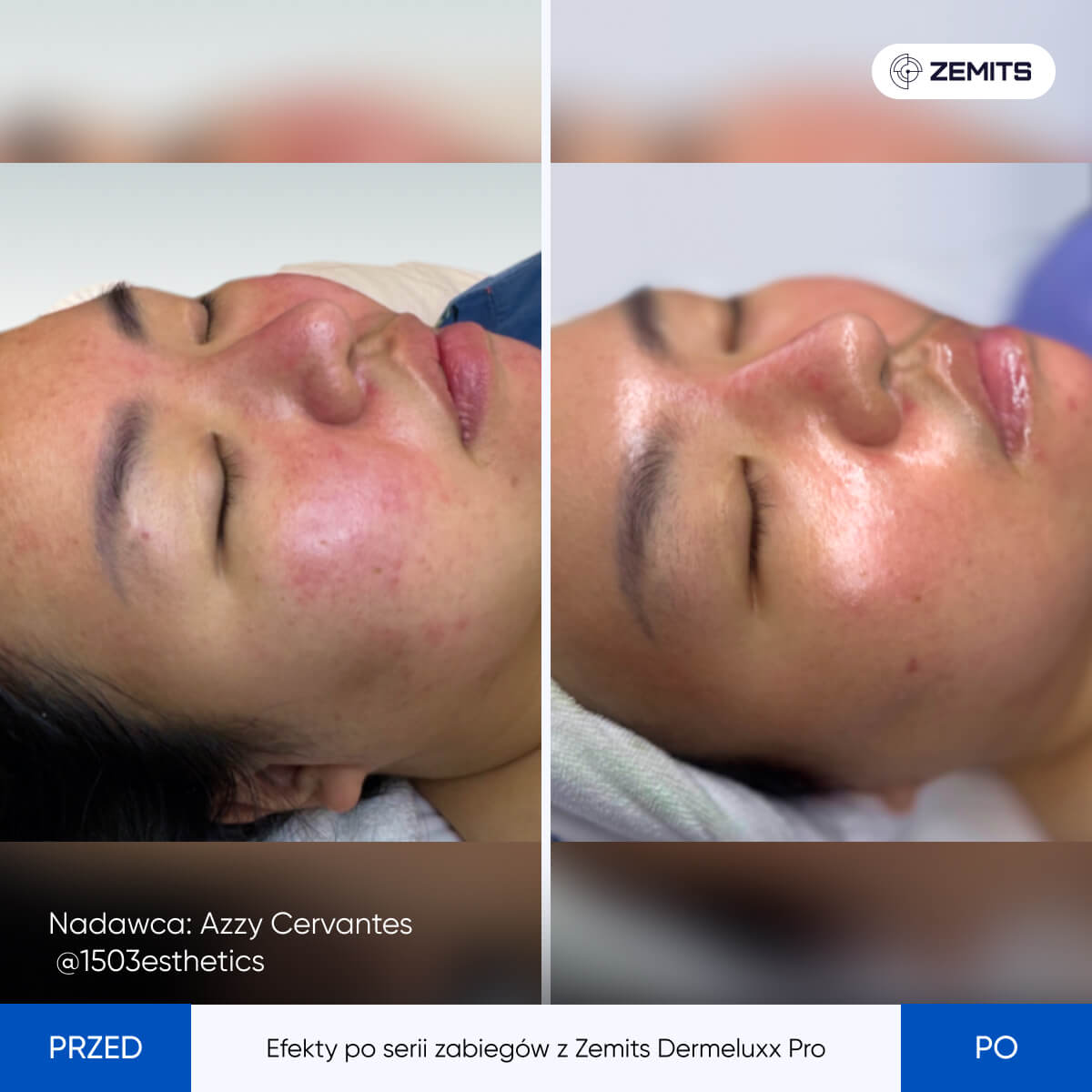 Before After Slide 12