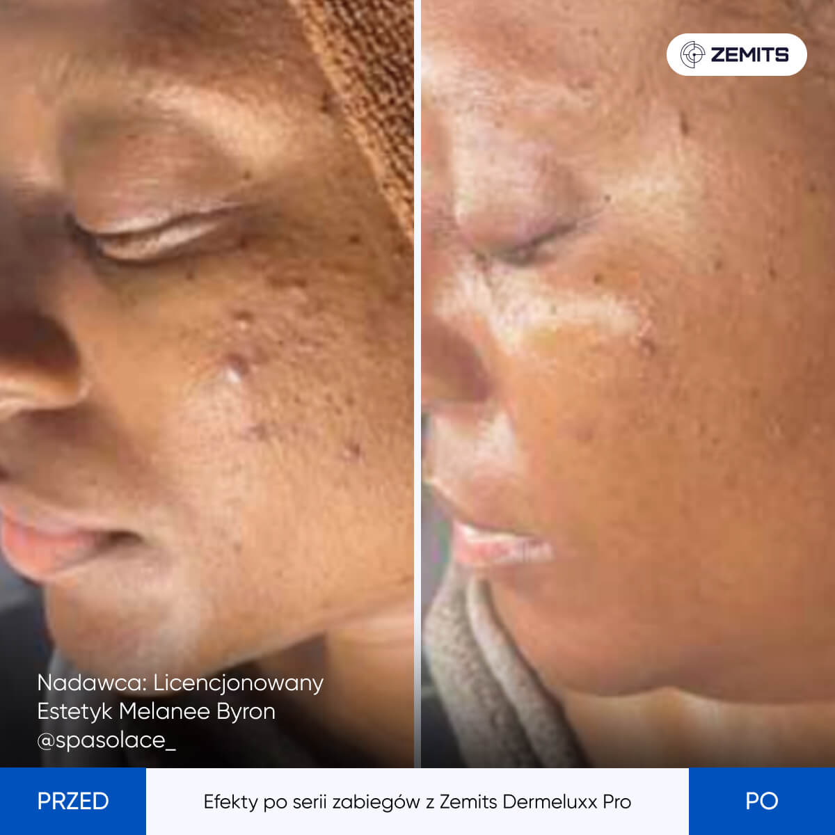 Before After Slide 18