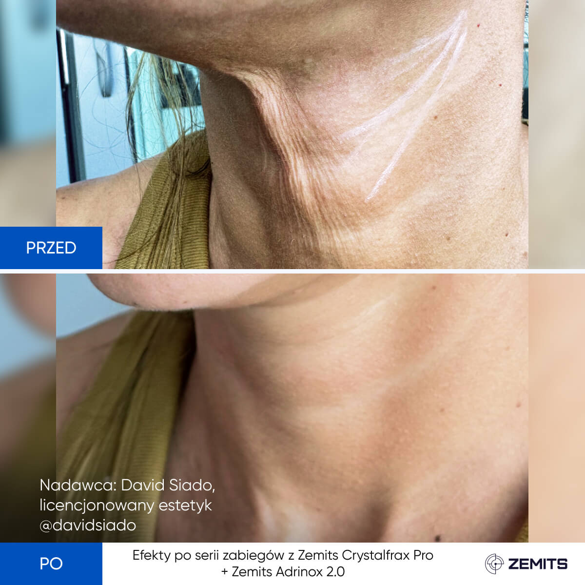Before After Slide 4