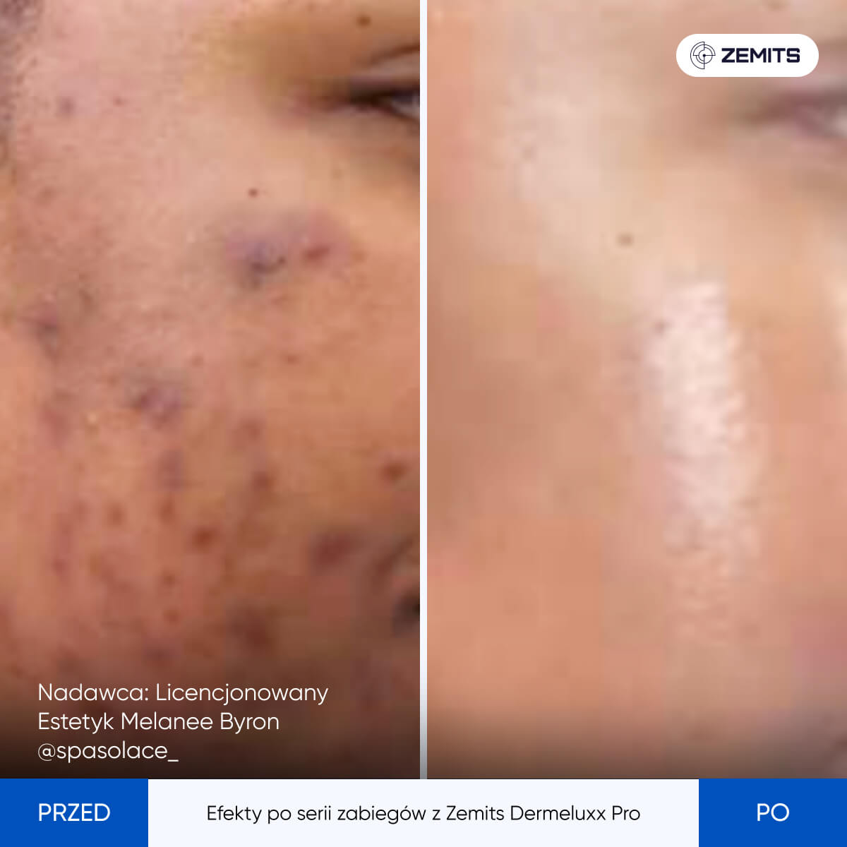 Before After Slide 19