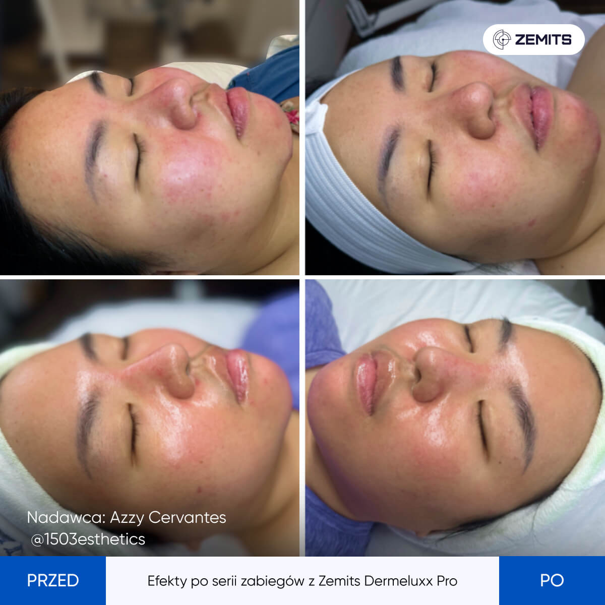 Before After Slide 21