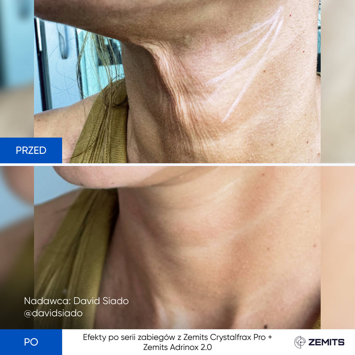 Before After Slide 15
