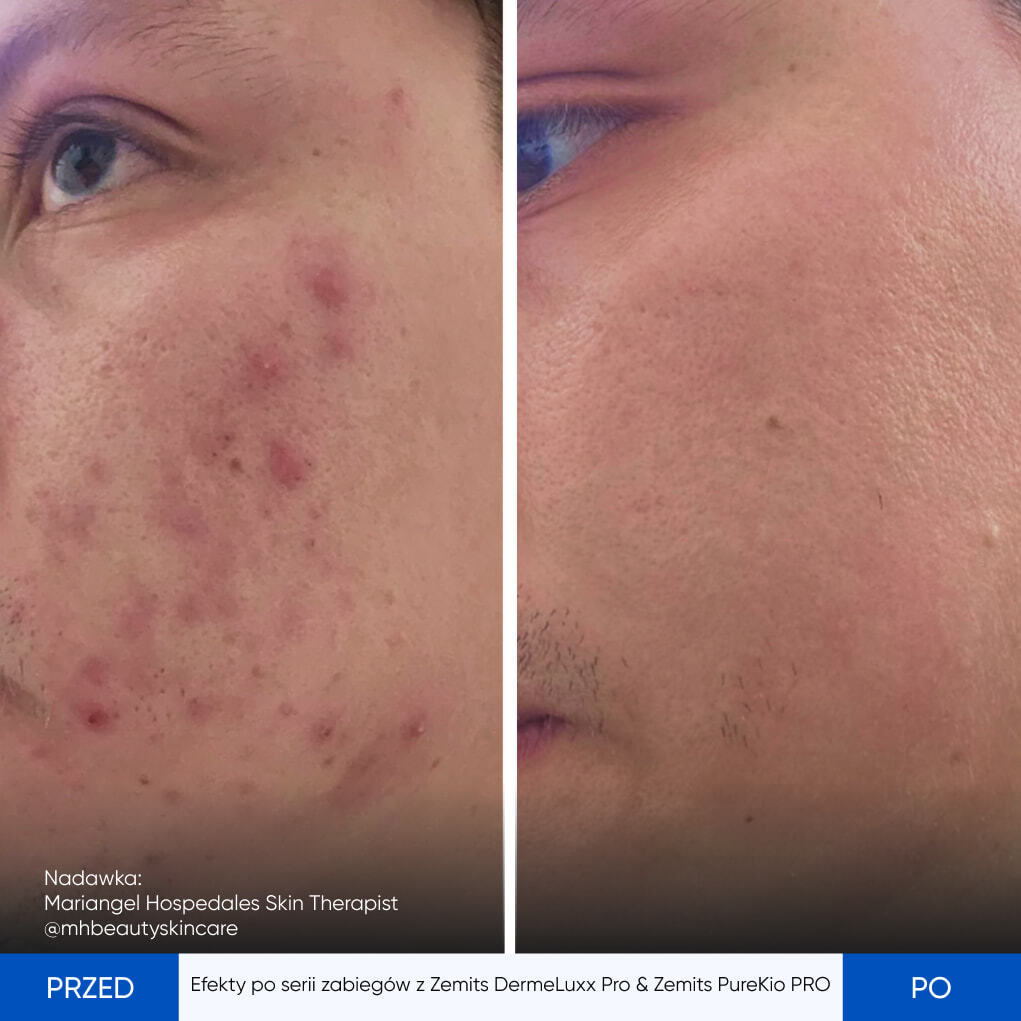 Before After Slide 2