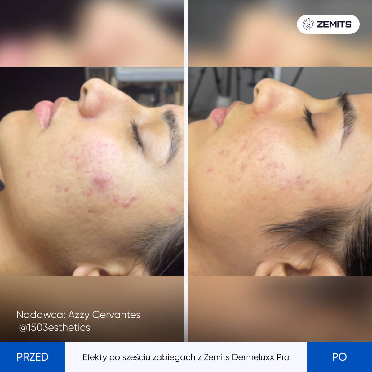 Before After Slide 13