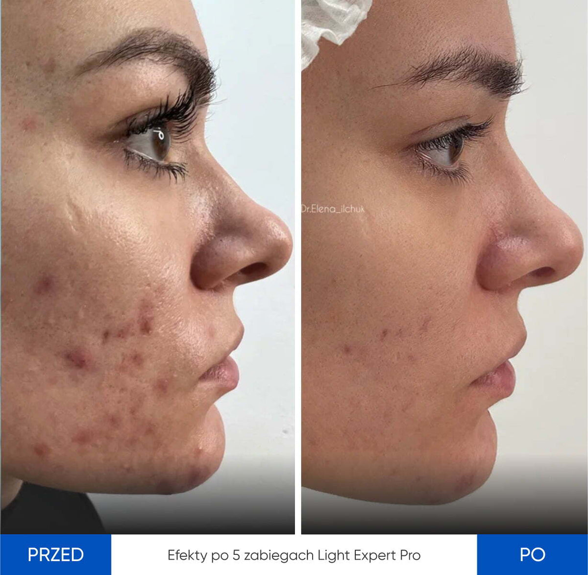 Before After Slide 2