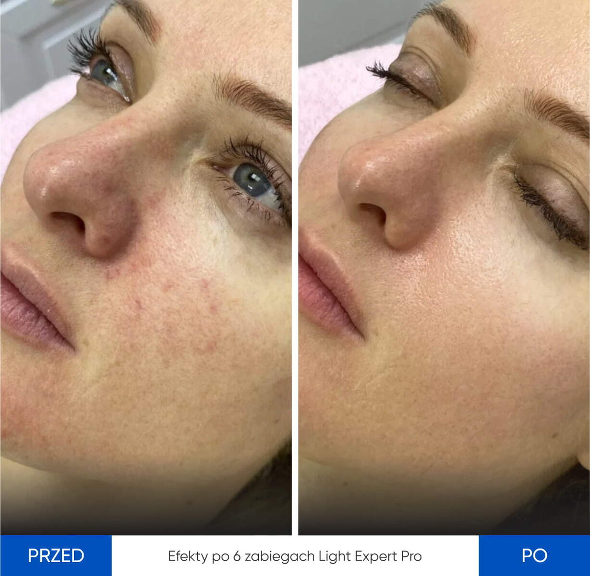 Before After Slide 3