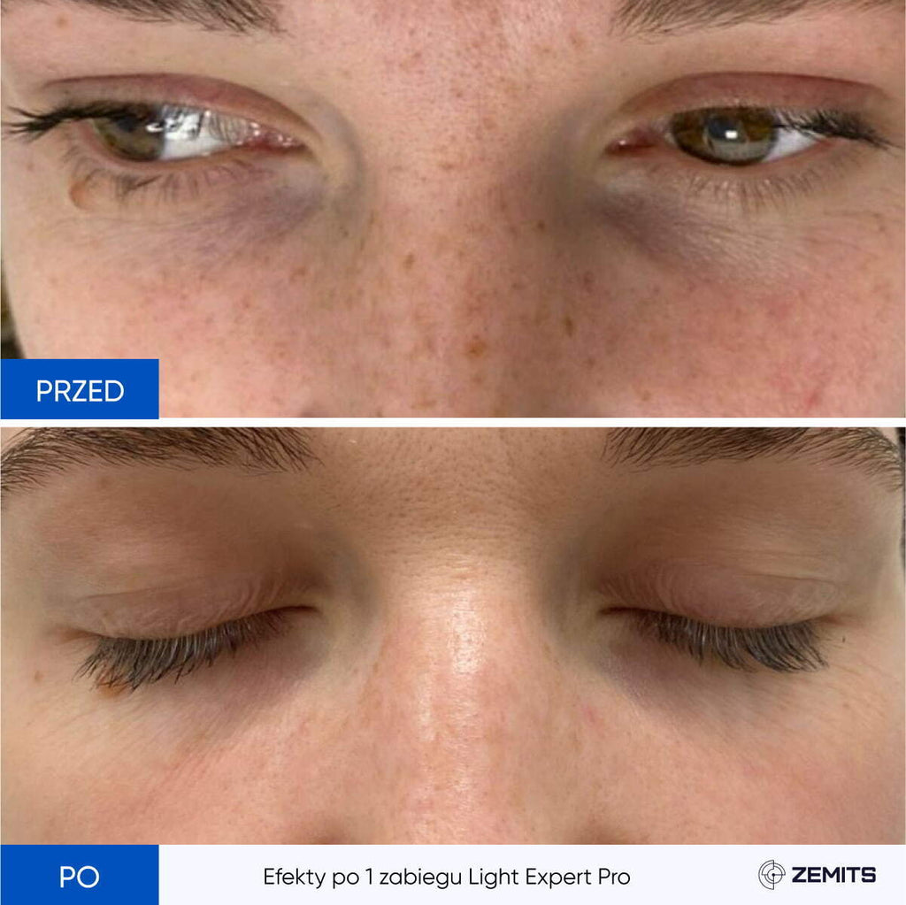 Zemits Light Expert Pro