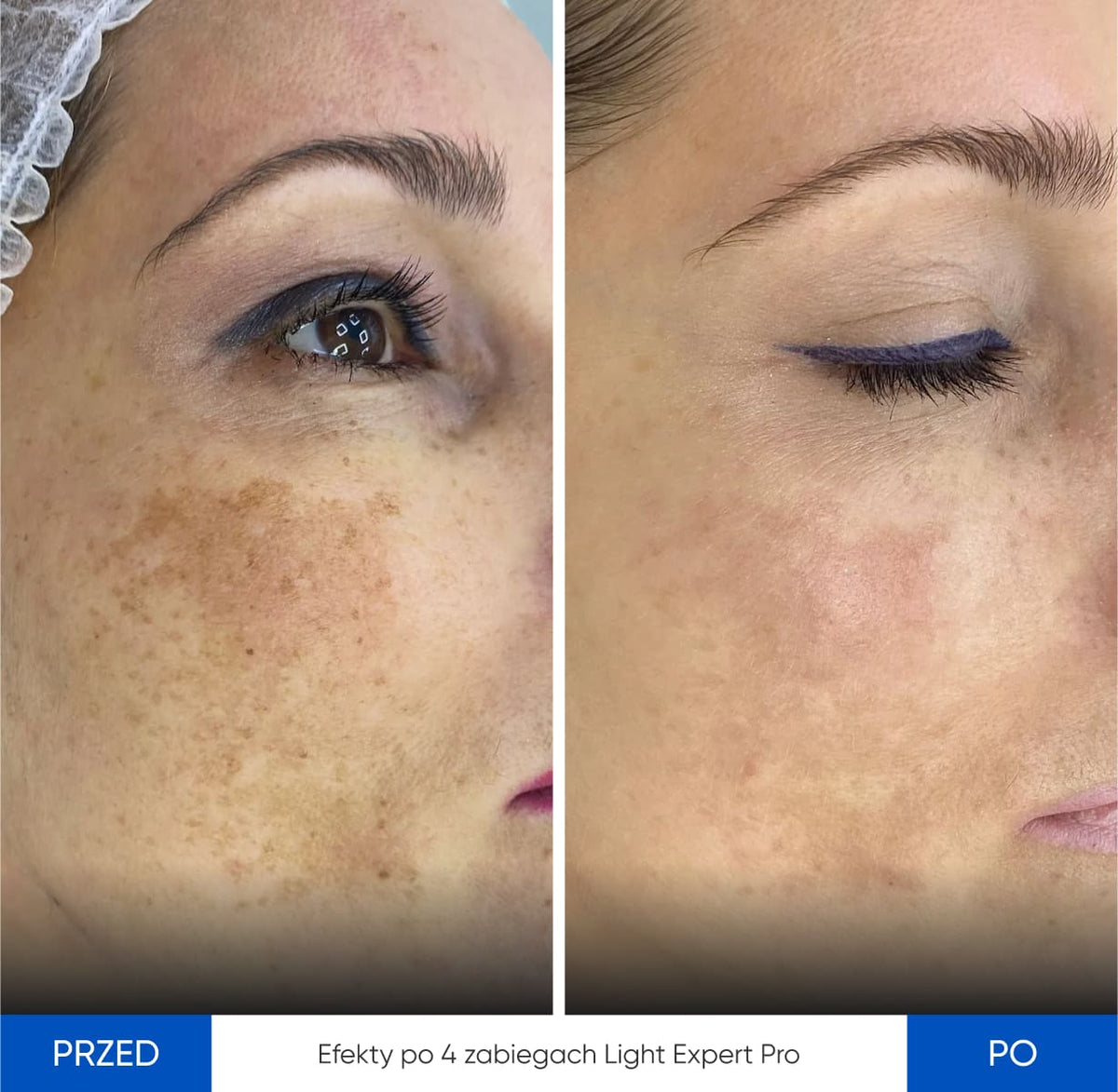 Zemits Light Expert Pro