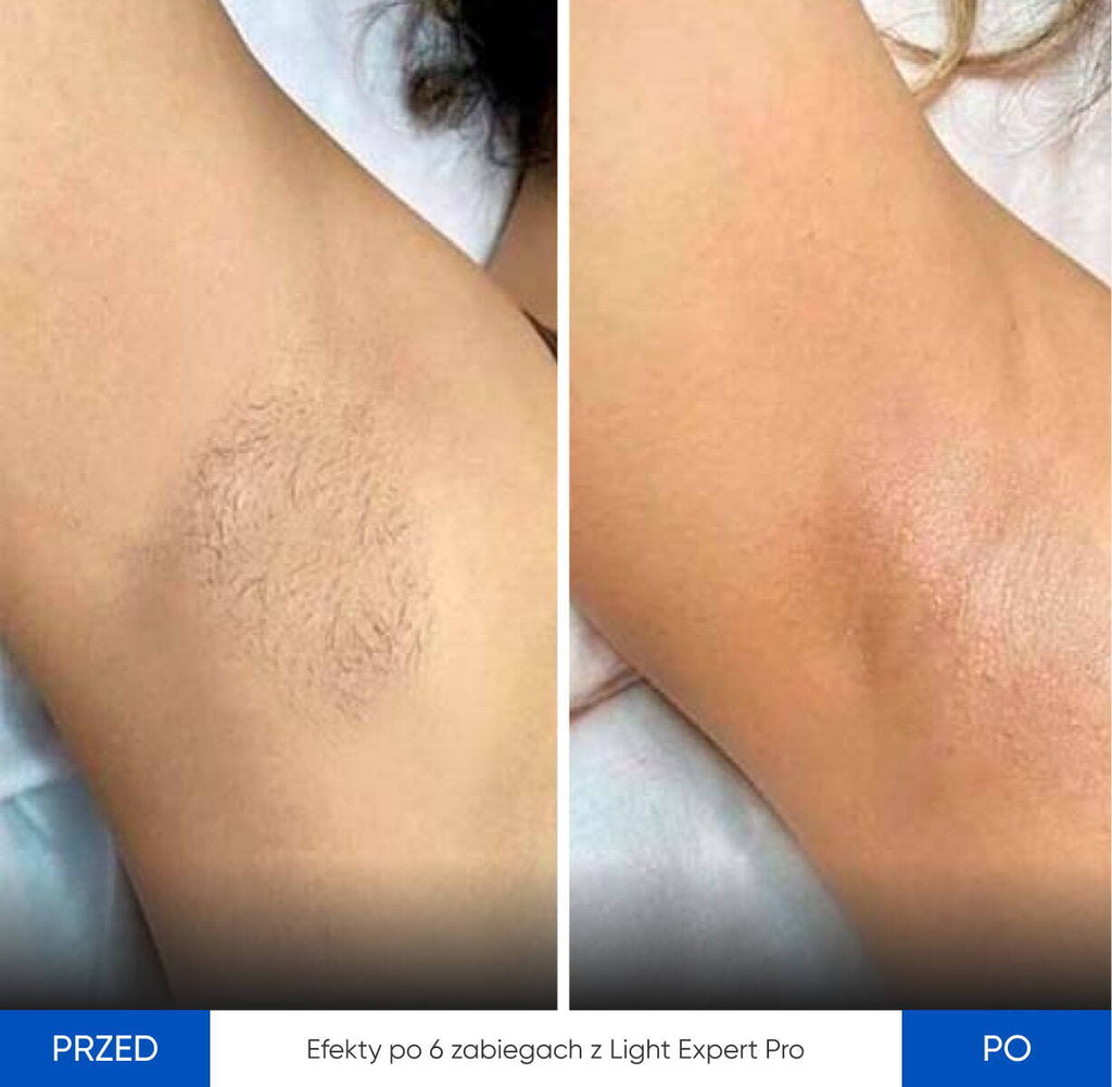 Zemits Light Expert Pro