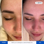 Zemits Meister NG