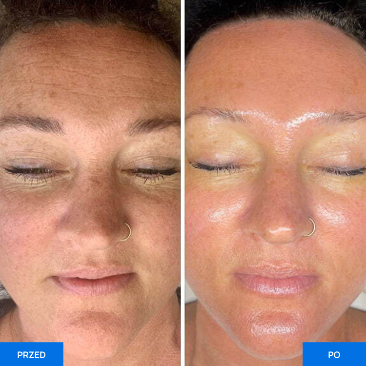 Before After Slide 2