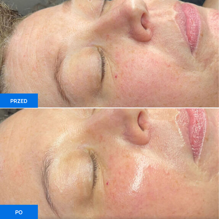 Before After Slide 3