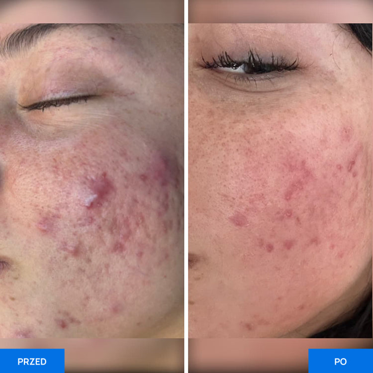Before After Slide 4