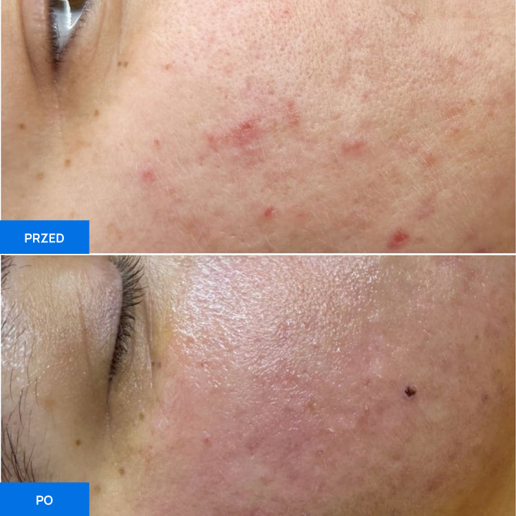 Before After Slide 2
