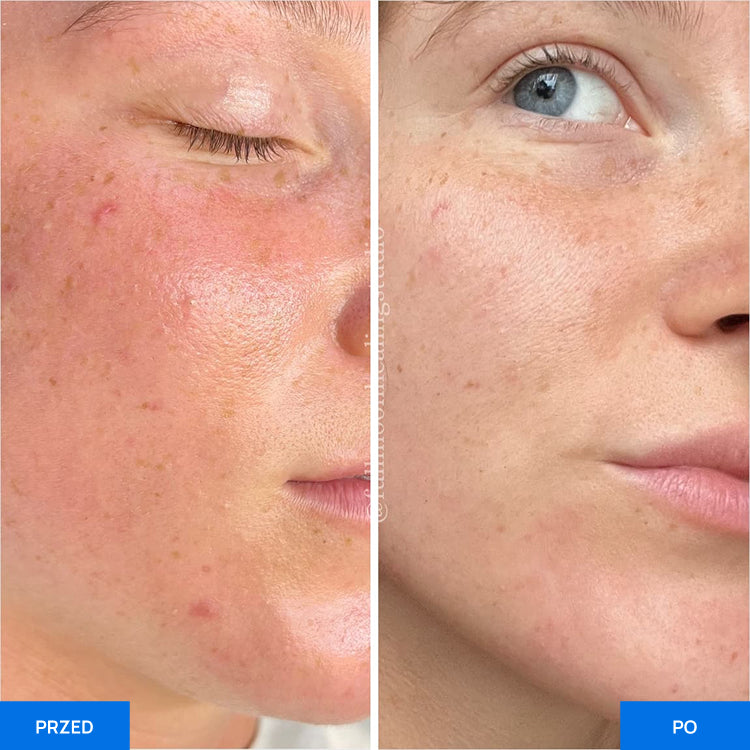 Before After Slide 3