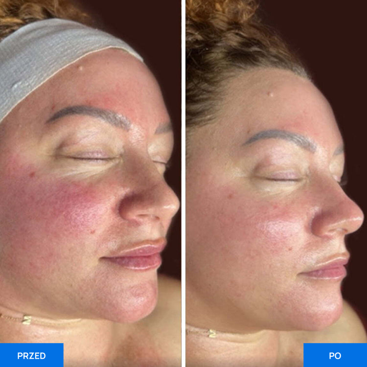 Before After Slide 2