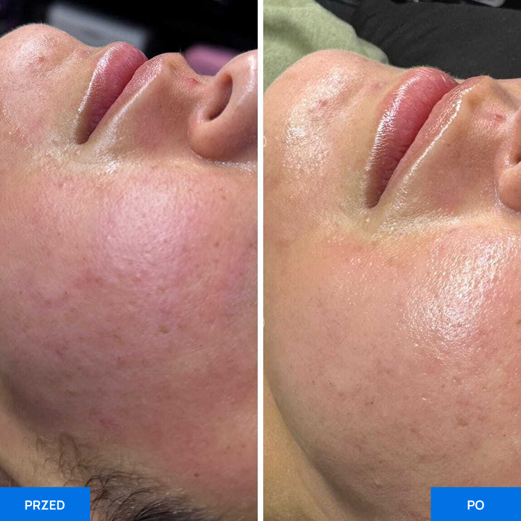 Before After Slide 3