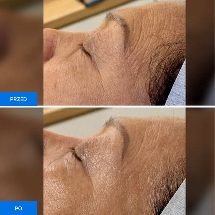 Before After Slide 1