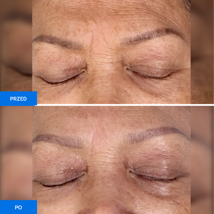 Before After Slide 2