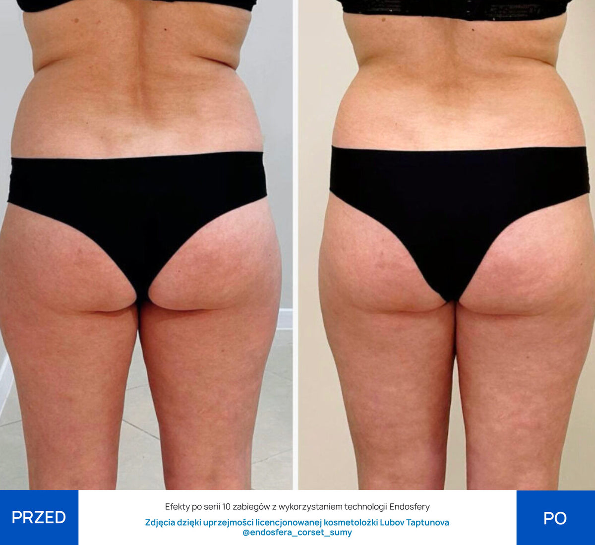 Before After Slide 1