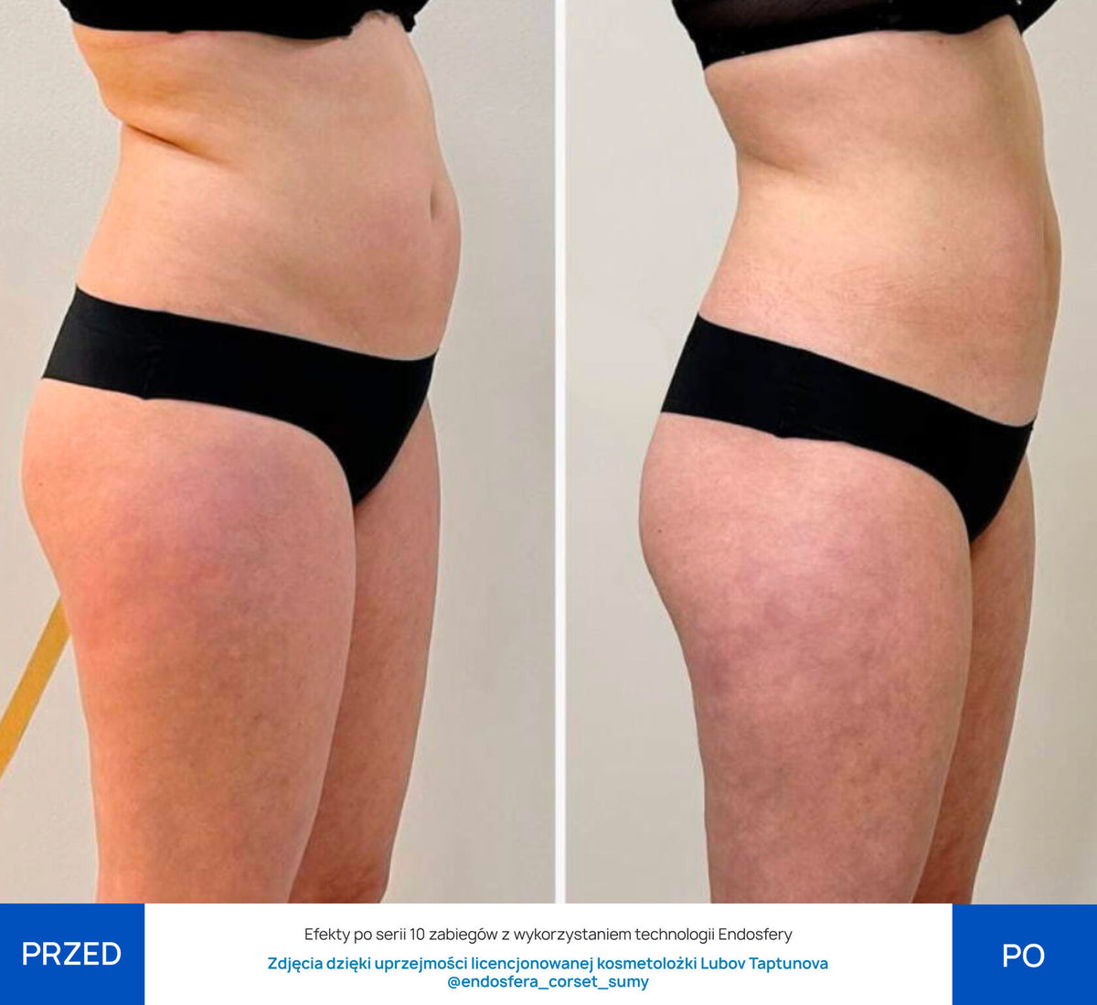 Before After Slide 2