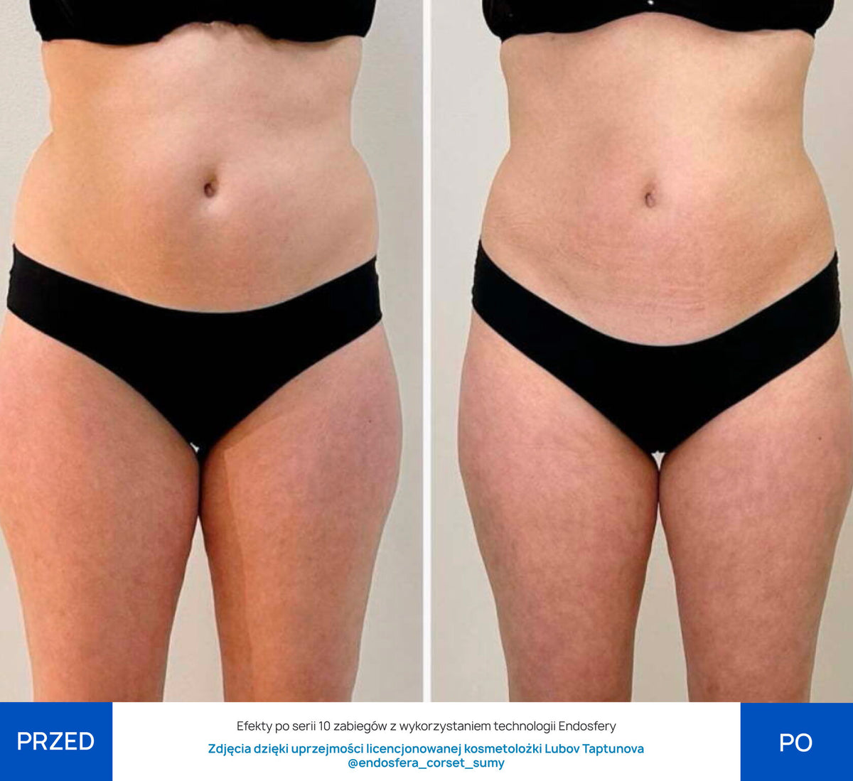 Before After Slide 3