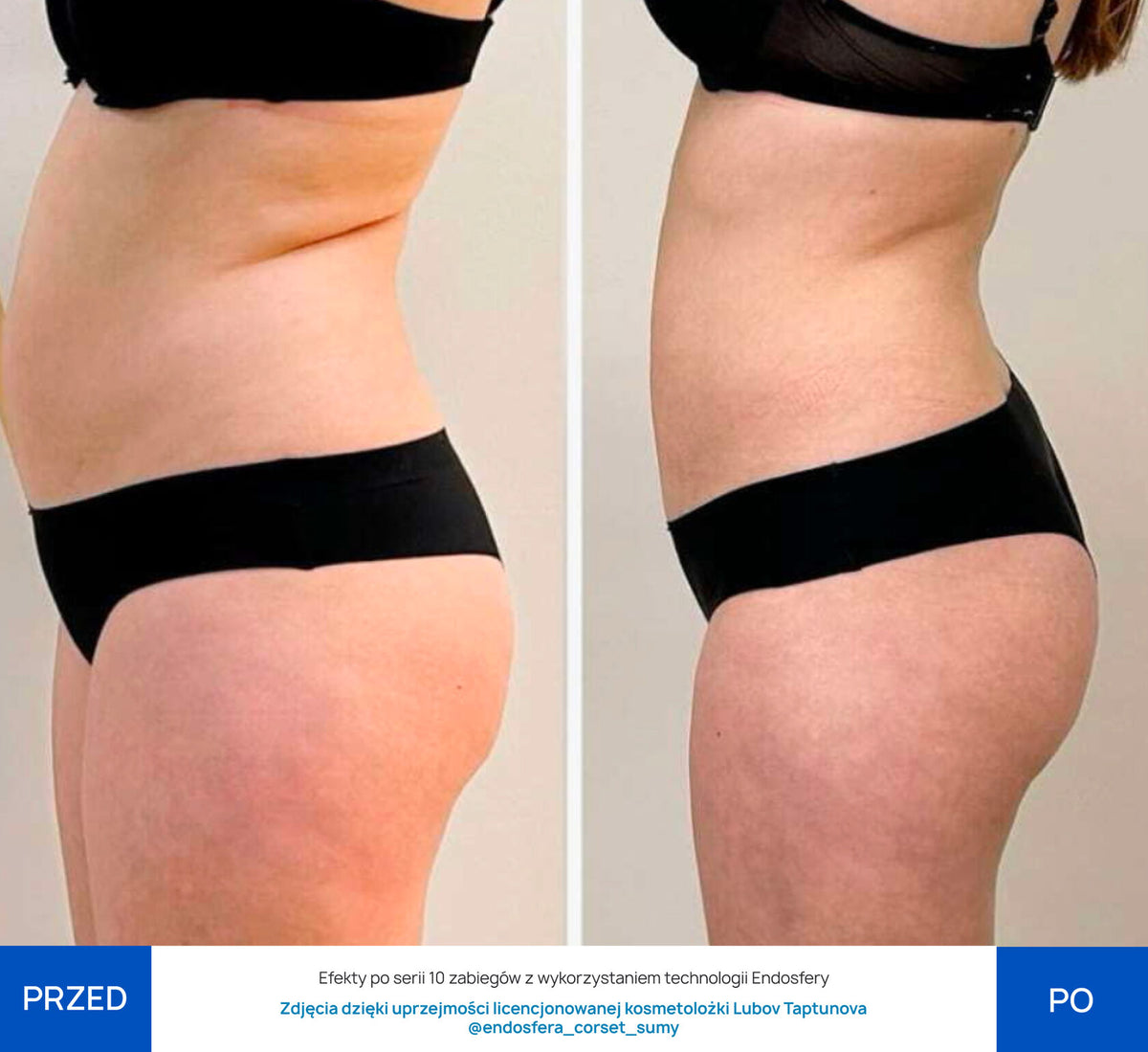 Before After Slide 4