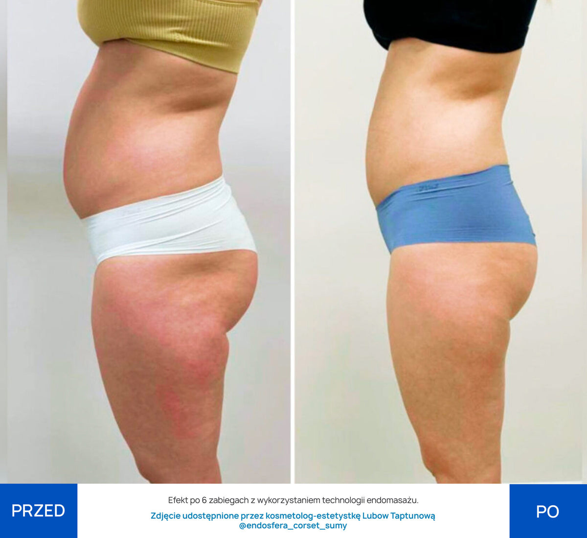 Before After Slide 7