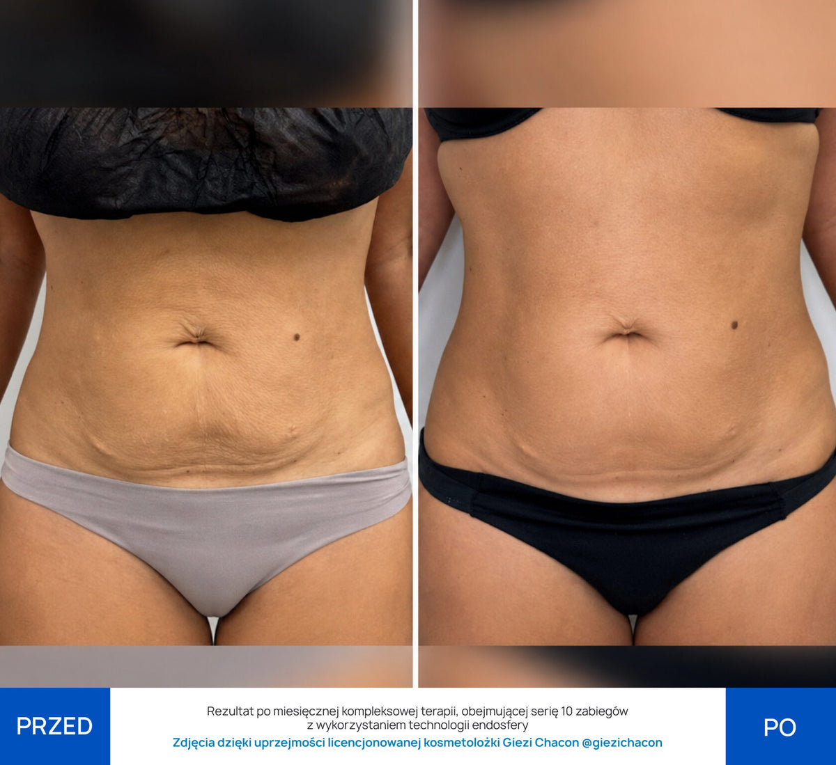 Before After Slide 1