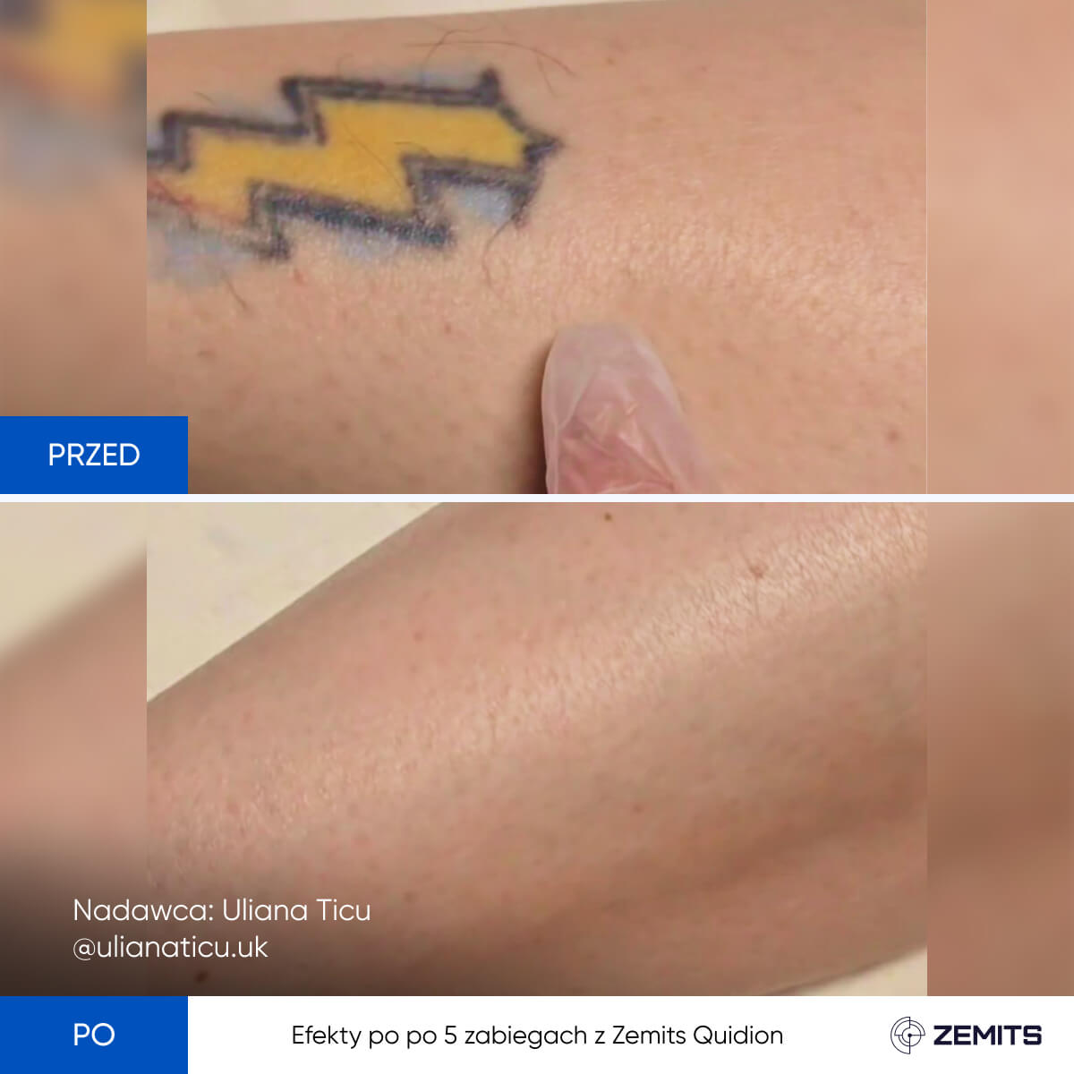 Before After Slide 3