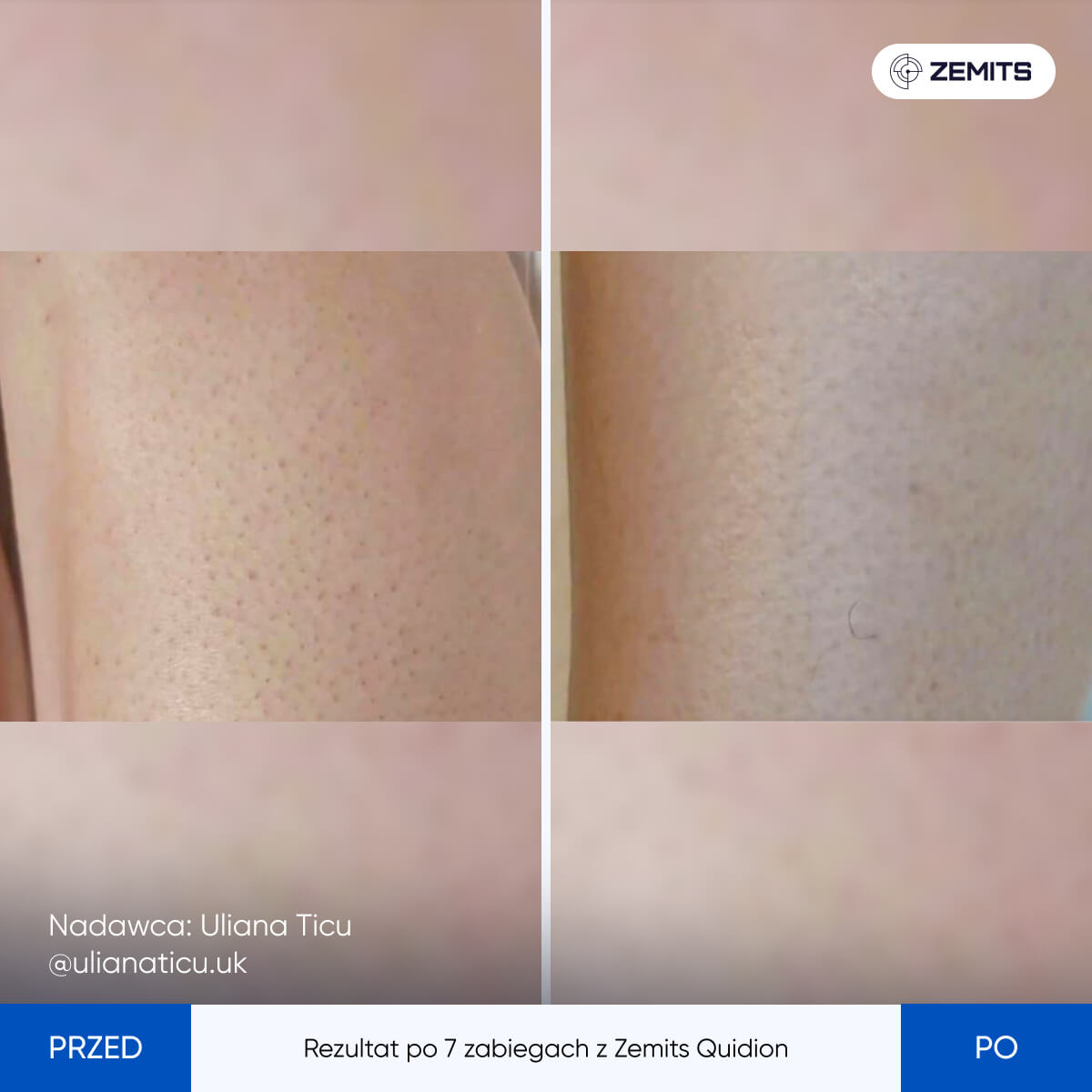 Before After Slide 6