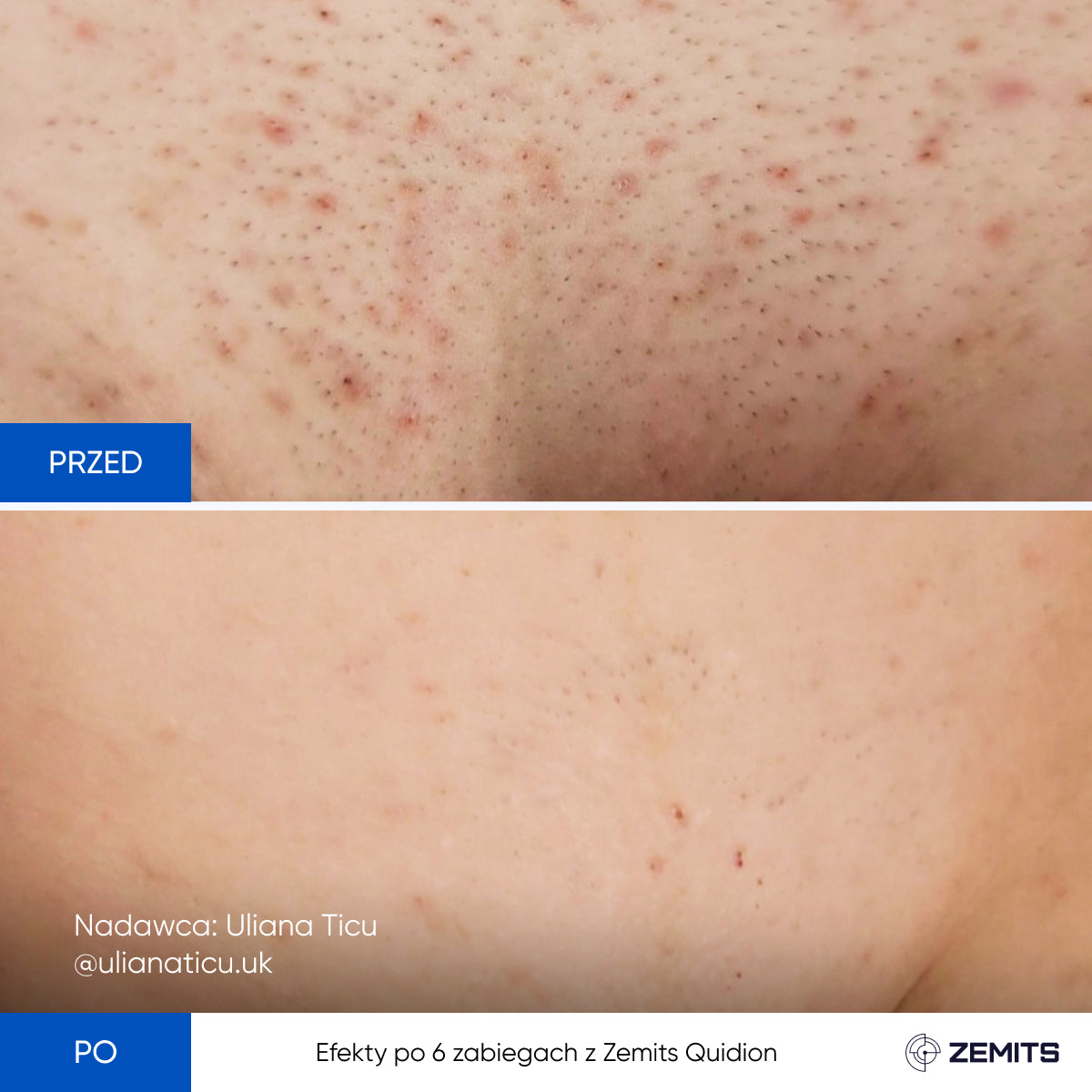 Before After Slide 5