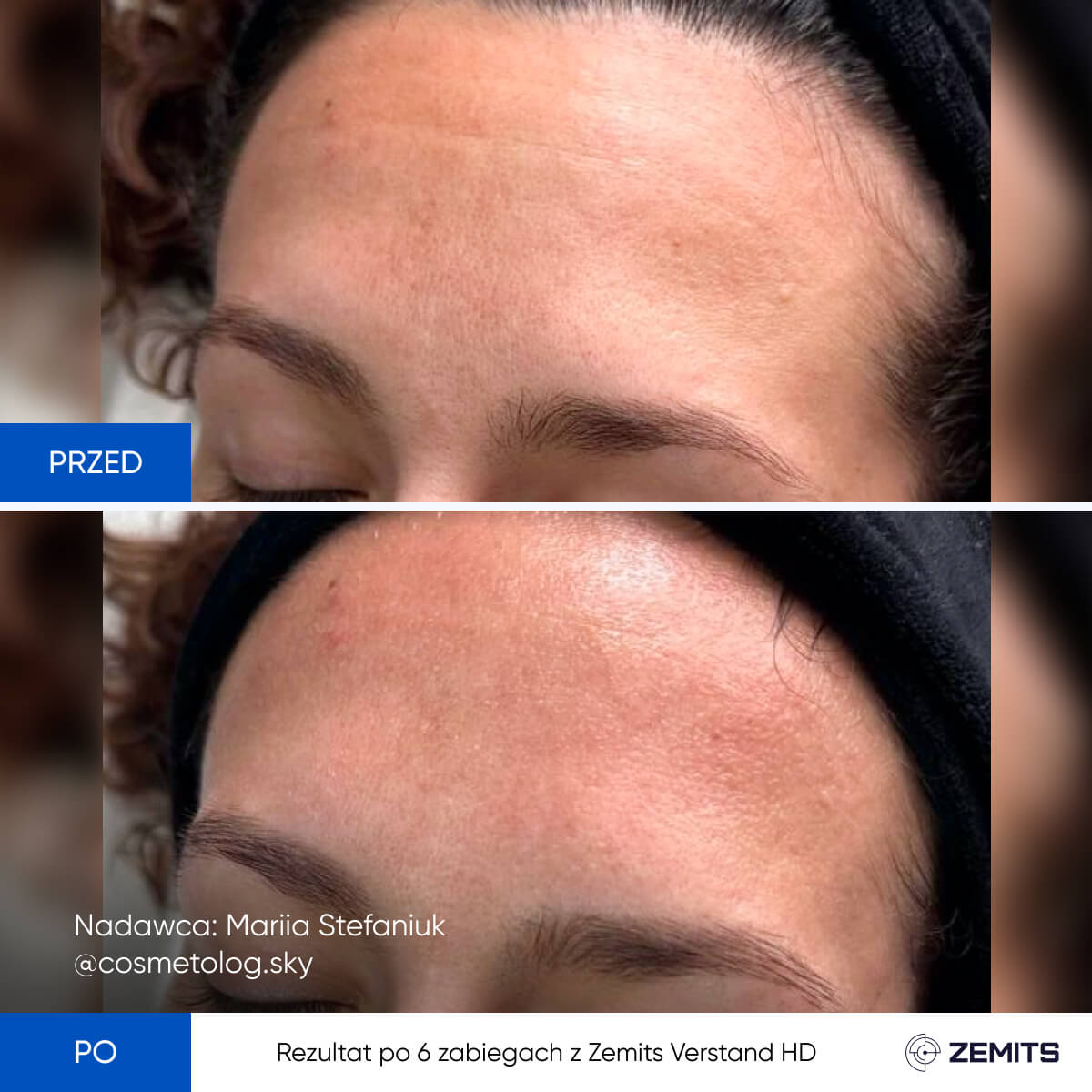 Before After Slide 3