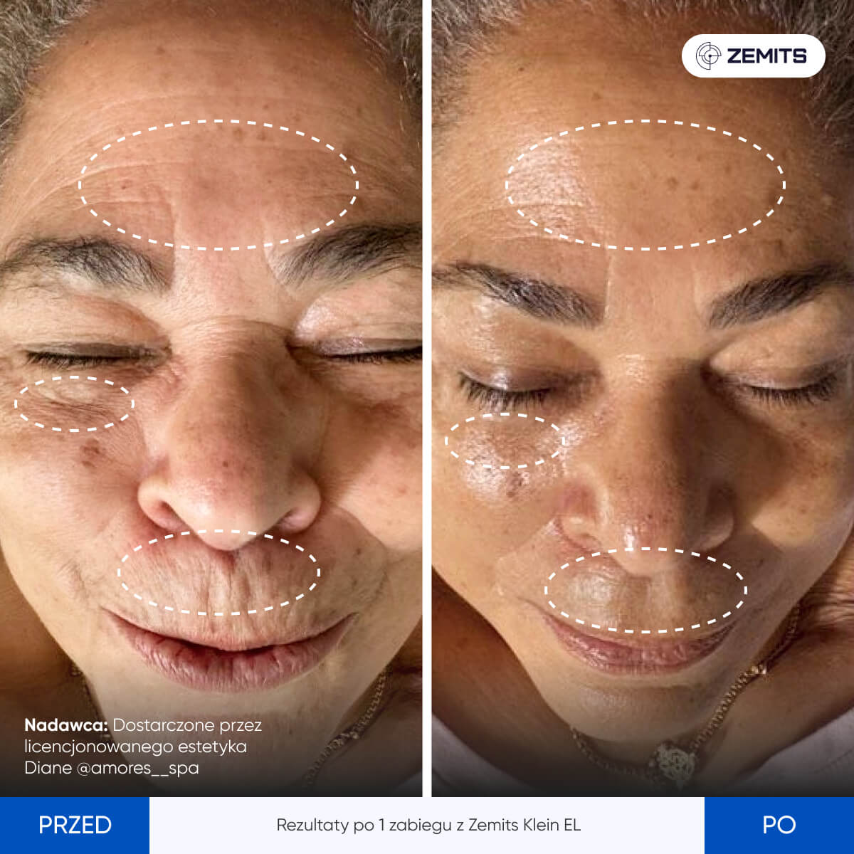 Before After Slide 4